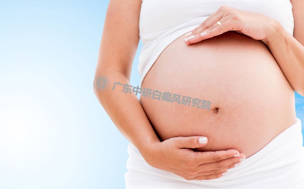 治疗孕妇白癜风最安全有效的方法