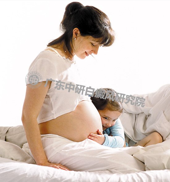 孕妇肚子上的白癜风该怎么治疗？